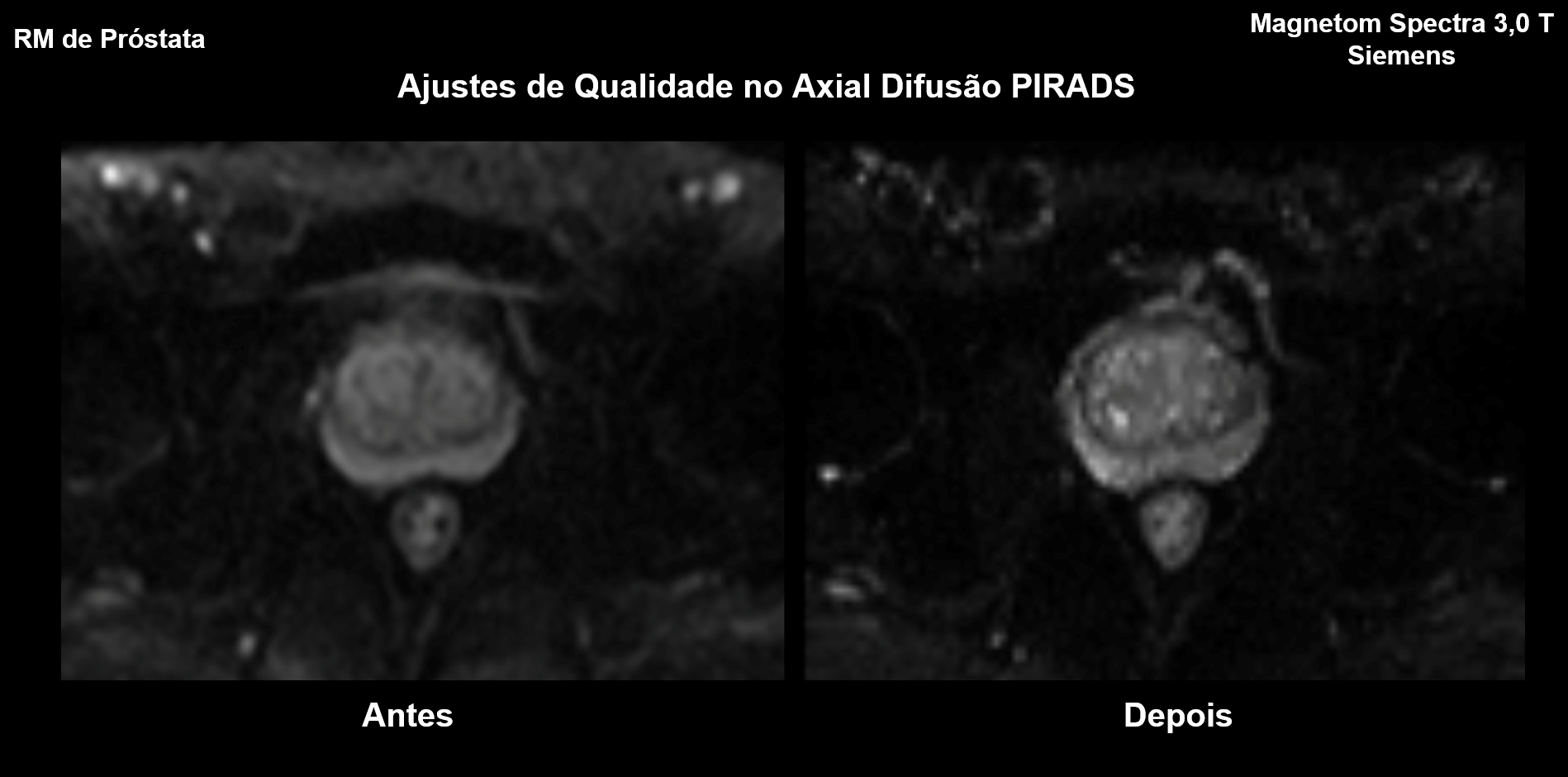 Melhorando a Efici&ecirc;ncia e a Qualidade dos Exames de Resson&acirc;ncia Magn&eacute;tica: Um Caso de Sucesso com a Unimed Chapec&oacute; e MRIONLINE