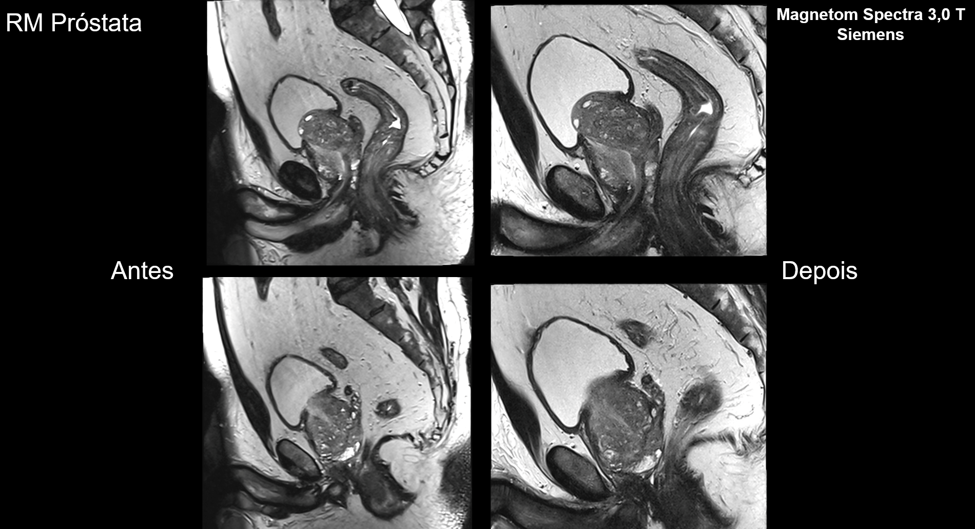 Melhorando a Efici&ecirc;ncia e a Qualidade dos Exames de Resson&acirc;ncia Magn&eacute;tica: Um Caso de Sucesso com a Unimed Chapec&oacute; e MRIONLINE
