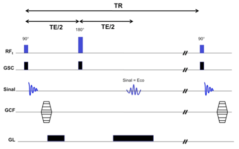 Par&acirc;metros TR e TE: o que s&atilde;o e o que fazem na RM