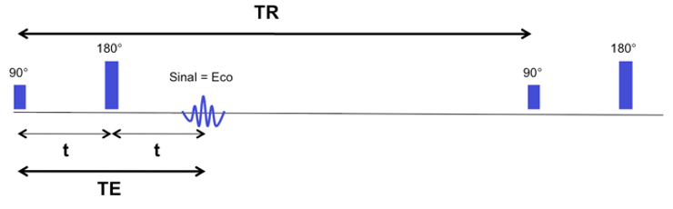 Par&acirc;metros TR e TE: o que s&atilde;o e o que fazem na RM