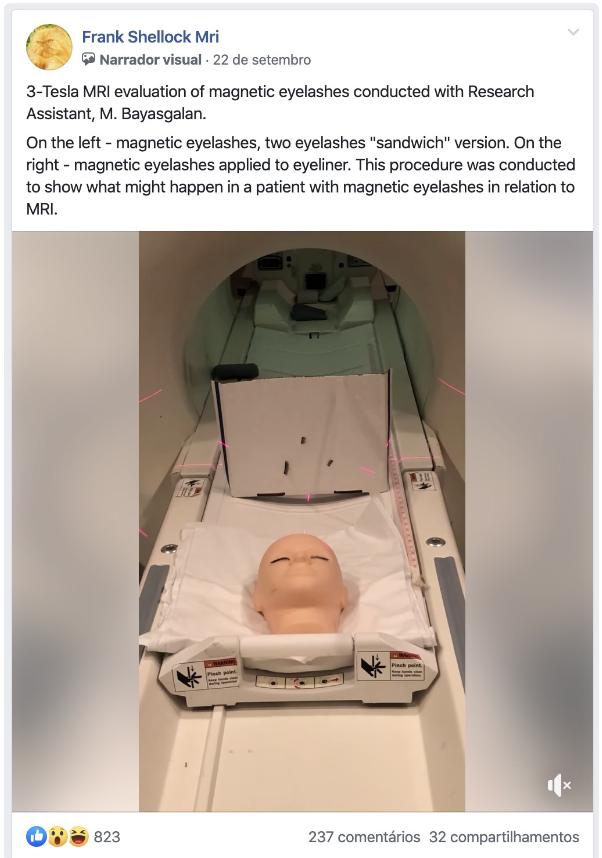 Fake News sobre Cílios Postiços, Queimaduras e Ressonância Magnética - Nota de Esclarecimento do MRI Fake News sobre Cílios Postiços, Queimaduras e Ressonância Magnética - Nota de Esclarecimento do MRI