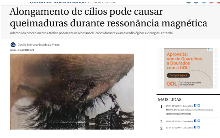 Fake News sobre Cílios Postiços, Queimaduras e Ressonância Magnética - Nota de Esclarecimento do MRI Fake News sobre Cílios Postiços, Queimaduras e Ressonância Magnética - Nota de Esclarecimento do MRI