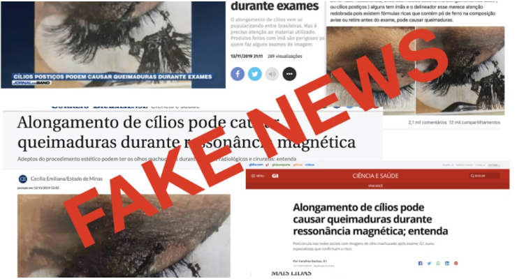 Fake News sobre C&iacute;lios Posti&ccedil;os, Queimaduras e Resson&acirc;ncia Magn&eacute;tica - Nota de Esclarecimento do MRI